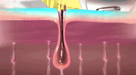 6.png