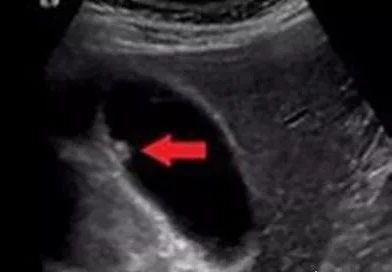 1615866818898516.png 2.png