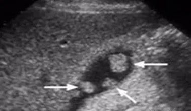 1615866830501613.png 3.png