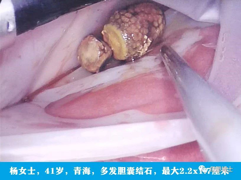 1615868059289354.png 1.png