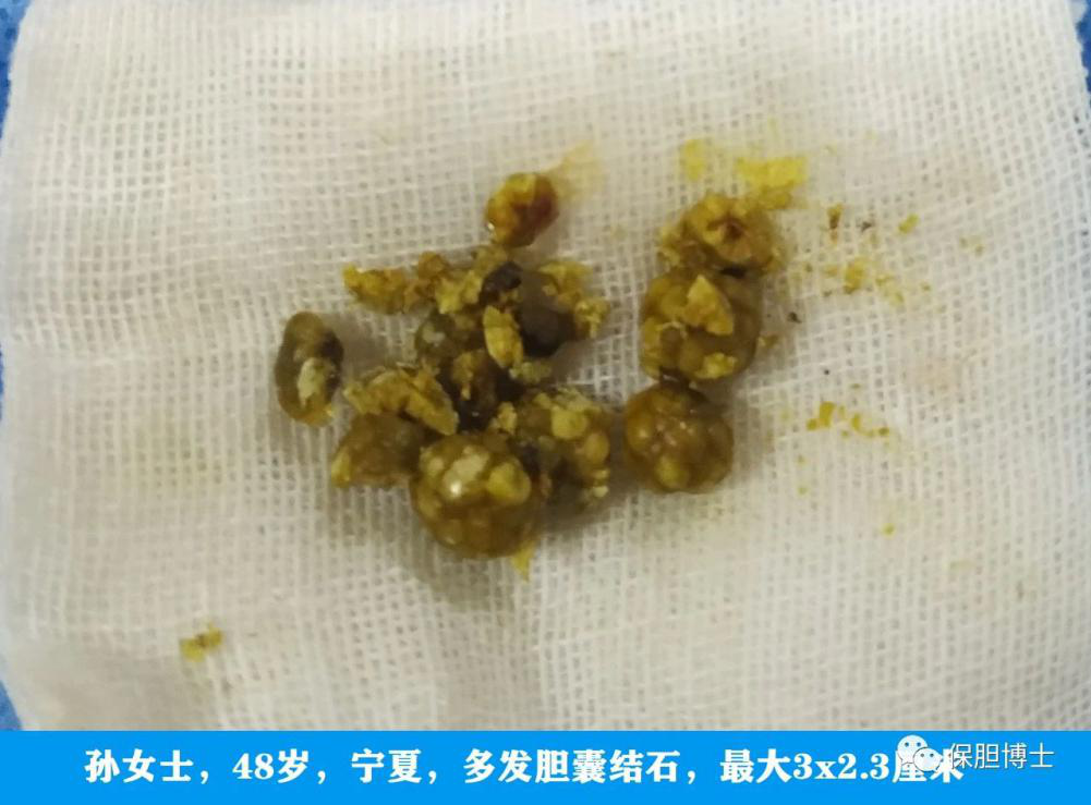 1615868128316519.png 1.png