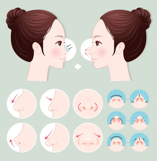 1650253523169574.png 1650253523169574.png